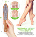 Lime Pour Pieds Professionelle Avec Manche En Bois. Aucun Risque De Blessure. Utilisée Dans Les Salons De Pédicure. Râpe En Acier Inoxydable Découpée Au Laser. Multi-Usage